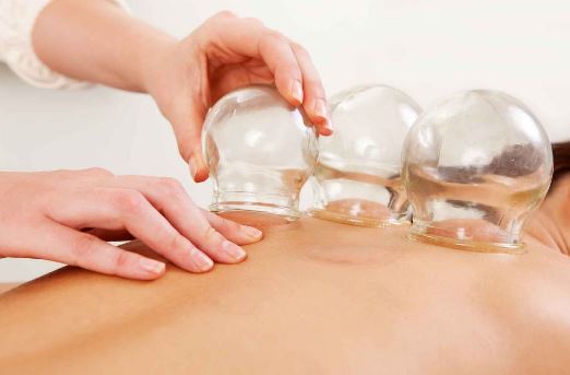 chinese body treatment cupping in Dania Beach